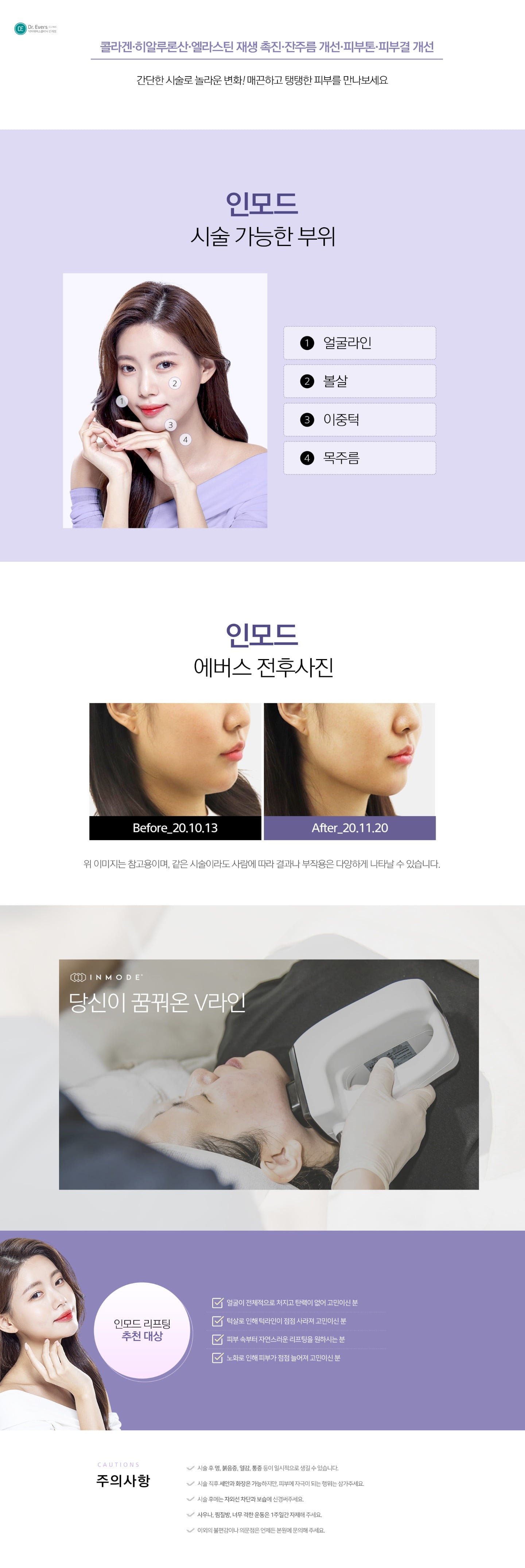 인모드 원리 및 효과 차이_닥터에버스의원 수원인계점