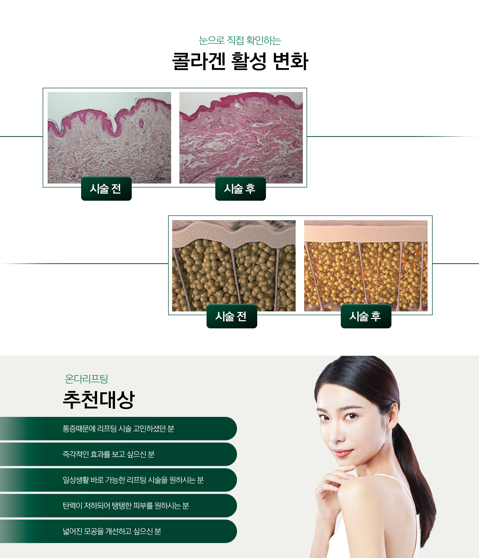 온다리프팅 수원피부과 닥터에버스