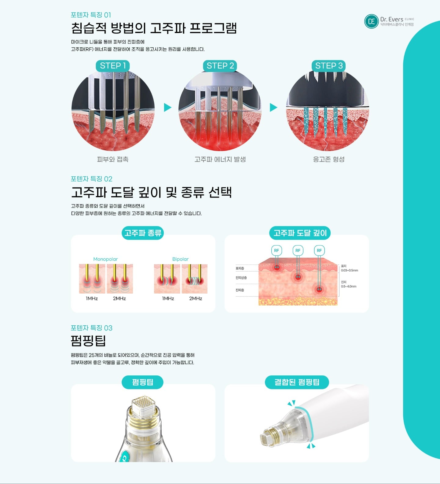 포텐자 시술의 원리와 안전성 — 닥터에버스의원 수원인계점