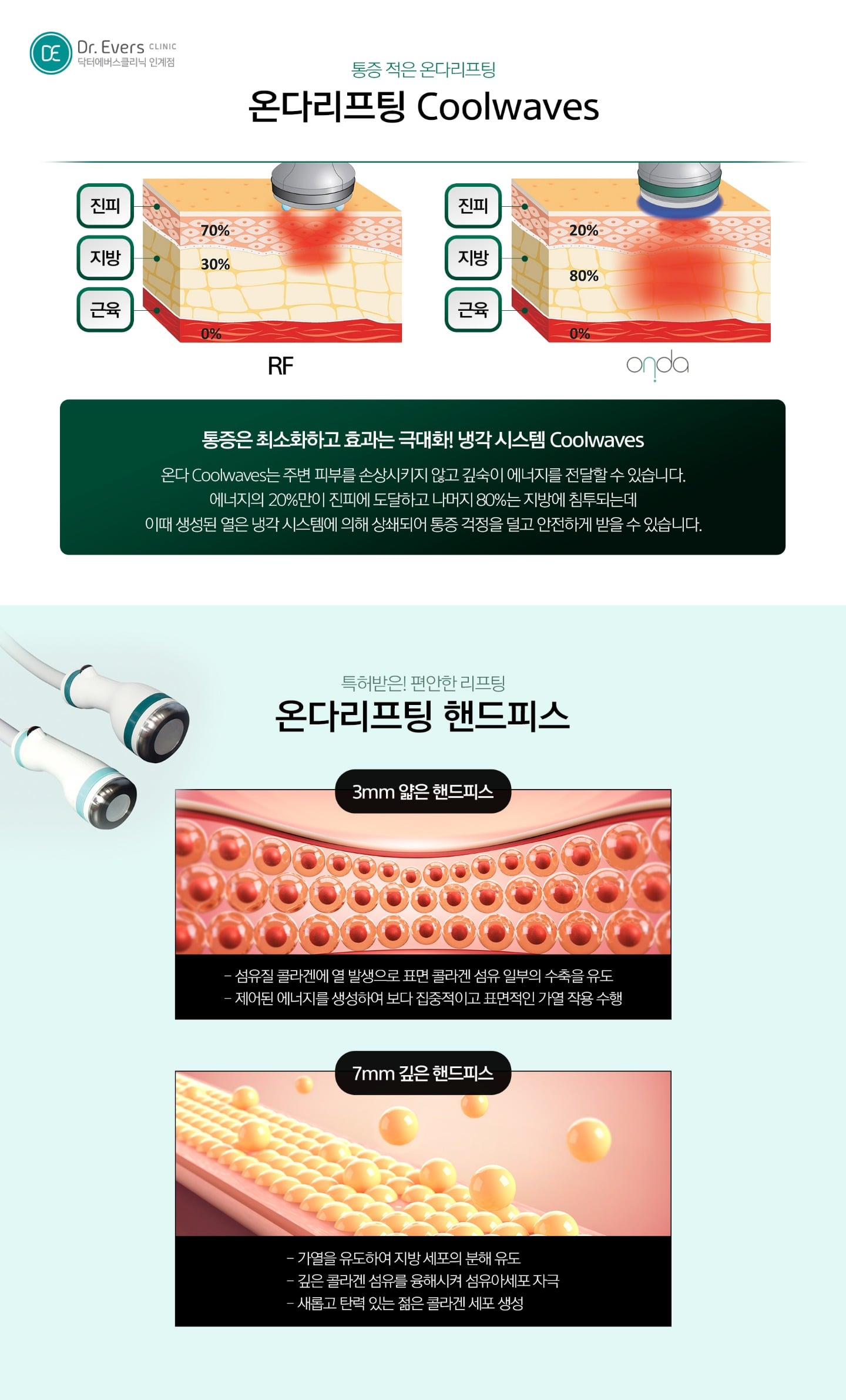 온다 리프팅의 에너지 축적 원리 — 닥터에버스의원 수원인계점