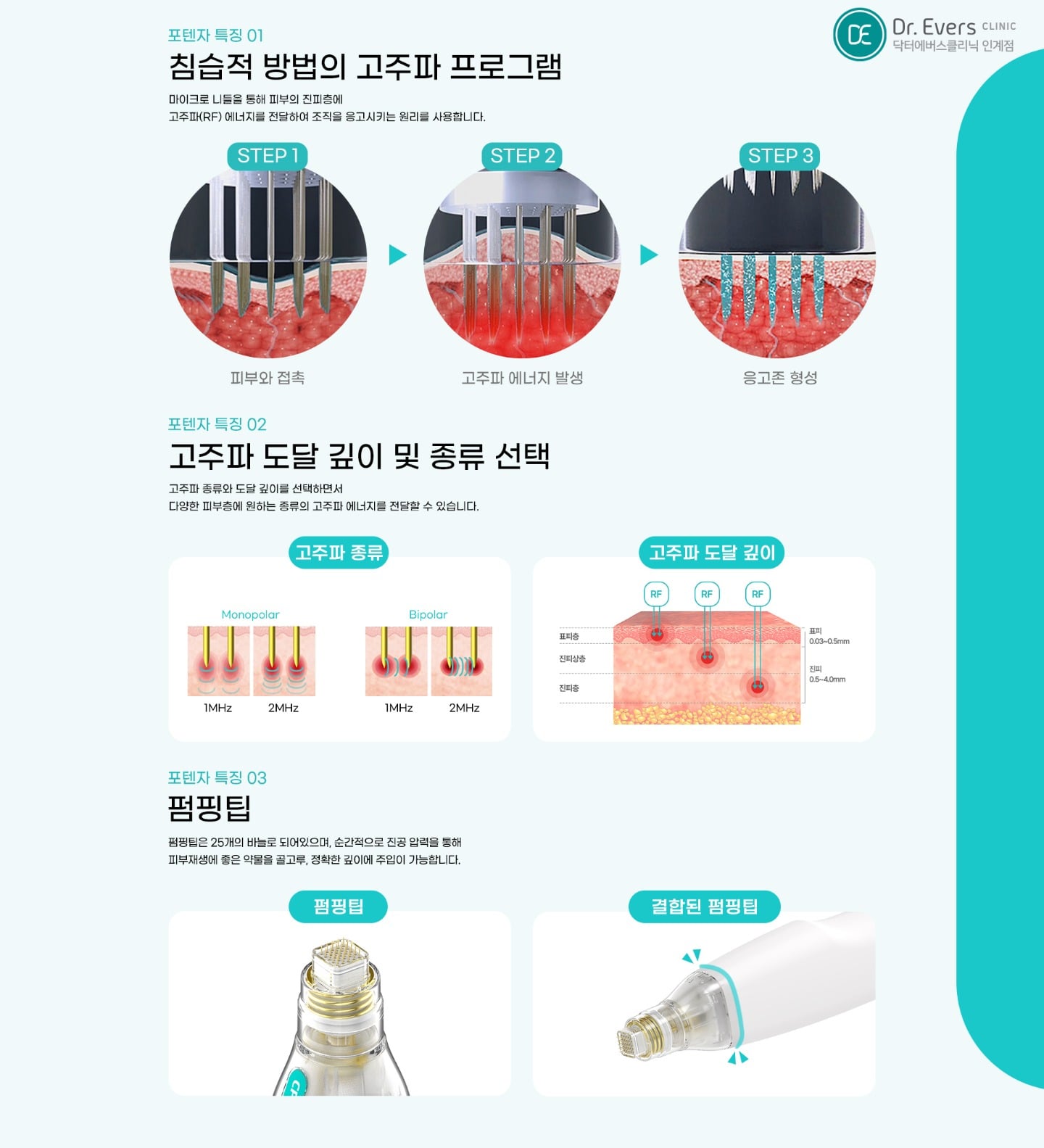 포텐자 시술의 원리와 안전성 — 닥터에버스의원 수원인계점